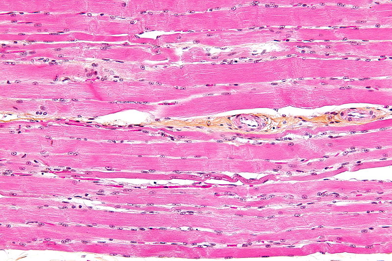 HPS stained Skeletal striated muscle